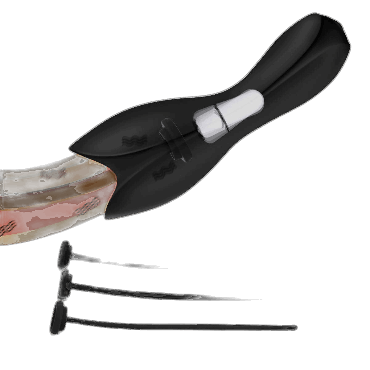 Vibrating Urethral Sound - 6 Separable Plugs