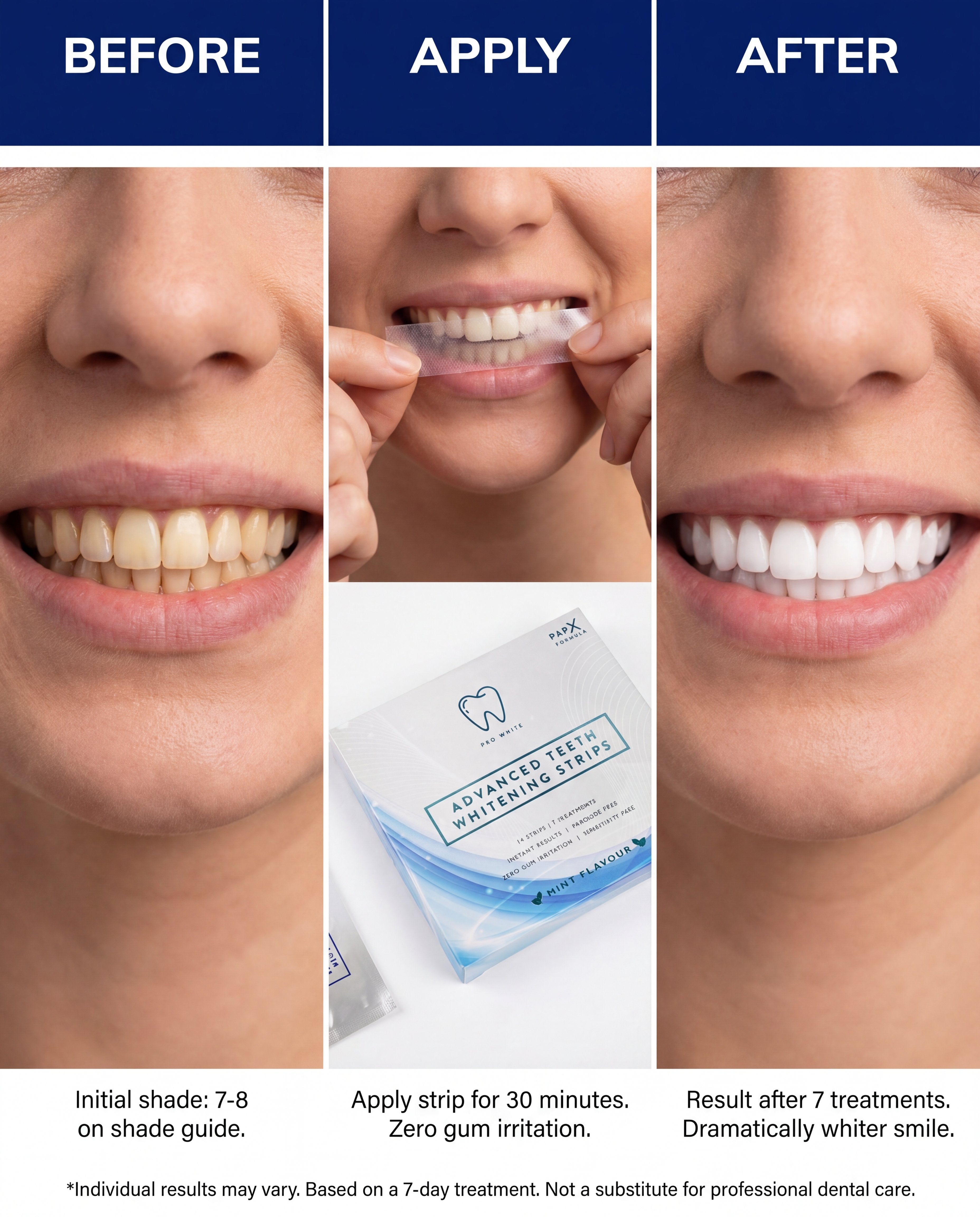 PAP-X™ Advanced Teeth Whitening Strips