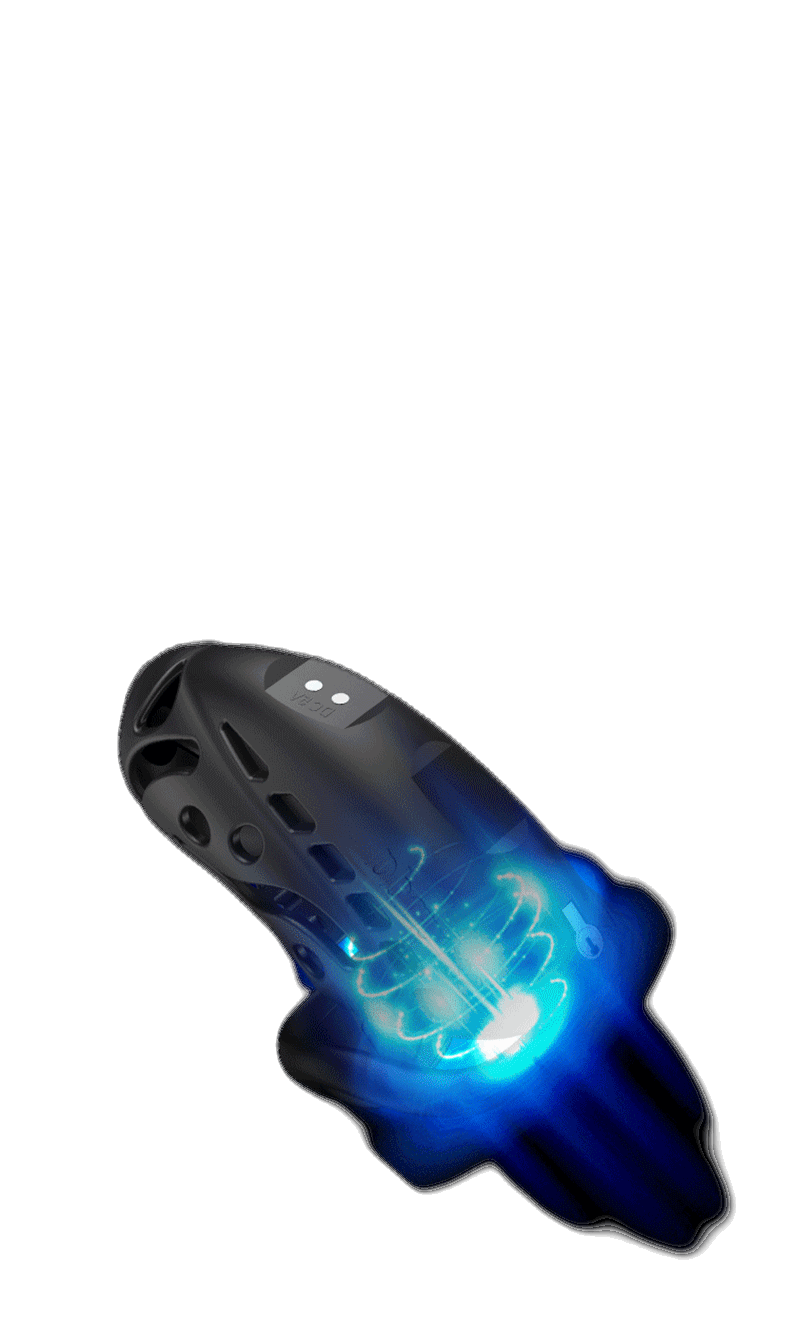 Remote Control Shock Chastity Cage