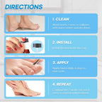 Aemerry Wart Corn Callus Remover – Maximum Strength Liquid Salicylic Acid for Feet (30ml)