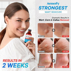 Aemerry Wart Corn Callus Remover – Maximum Strength Liquid Salicylic Acid for Feet (30ml)