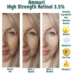 Retinol 3.5% Face Serum for Anti-Ageing & Skin Renewal | Ammuri