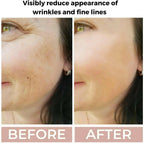 Retinol 3.5% Face Serum for Anti-Ageing & Skin Renewal | Ammuri