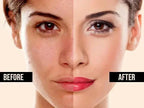 Lightening & Brightening Moisturiser for Face, Body & Sensitive Areas (50g) | Ammuri