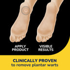 Dr Scholl's Clear Away Plantar Wart Remover - Extra-Thick Bandages for Feet, 24 Treatments