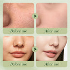 Etuanxi Avocado Skincare Set – 6-Piece Gift Kit (Cleanser, Serum, Moisturizer)