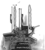 Stainless Steel Anal Dilator - Adjustable Anal Plug - Anal Speculum