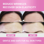 Forehead Wrinkle Patches Overnight Smoothing – Anti Wrinkle Patches for Face & Forehead | 12 pcs
