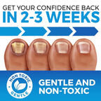 Imperial Feet Toe & Toenail Fungus Treatment – FDA Registered, Extra Strength Nail Care (USA)