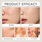 FOUNDATION MAKE-UP DISCOLORATION