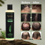Tgideas Organic Rosemary Hair Growth Shampoo for Women & Men – Thickening & Strengthening with Hydrolyzed Keratin | 2 x 7.4 fl oz