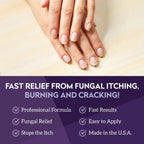 VITÉ20 V20 Antifungal Cream for Hands & Feet | Nail & Skin Care